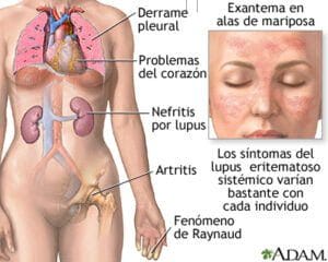 MEDILINEpLUS