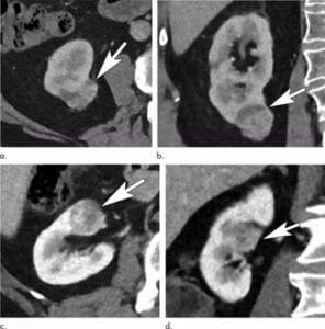 infosalus