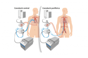 cirugía vascular angiología código aorta