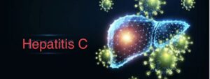 Hepatitis C 