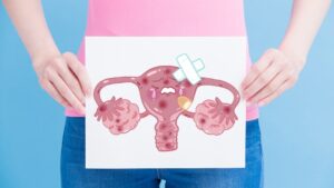 cáncer de cuello de útero