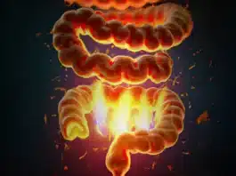 ¿Molestias intestinales recurrentes? ¡Esta podría ser la causa!