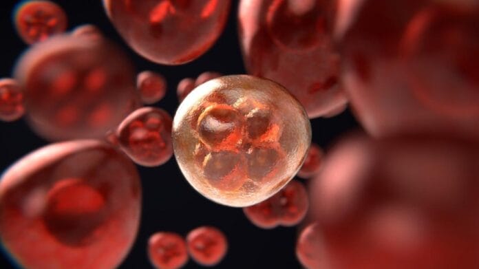 cáncer hematológico