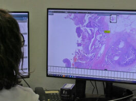 digitalización Vall d´Hebron