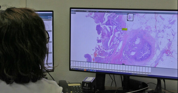 digitalización Vall d´Hebron