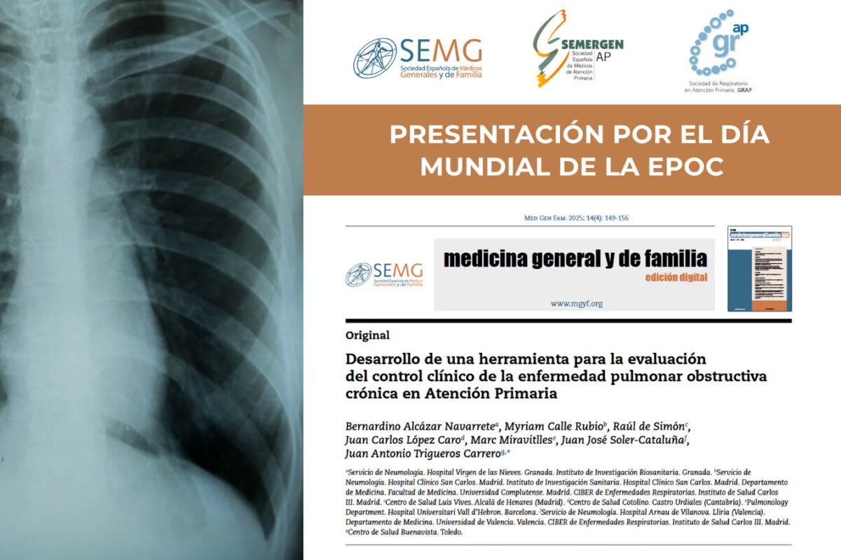 Rueda de prensa Dia Mundial EPOC