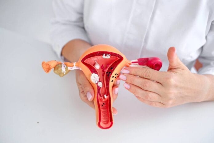 endometrosis