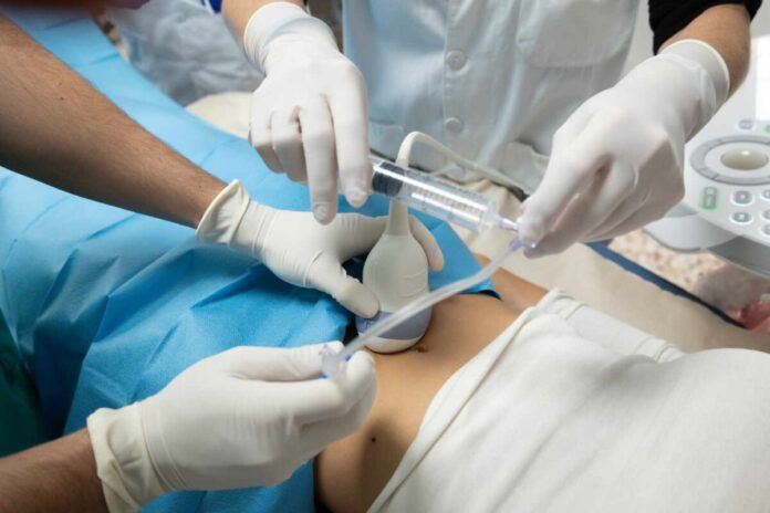 endometrosis Bellvitge