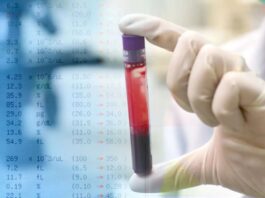 resultados de analisis