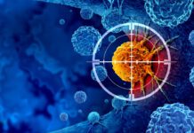 Cinco diagnósticos por minuto: la presión del cáncer sobre la sanidad europea alcanza niveles históricos