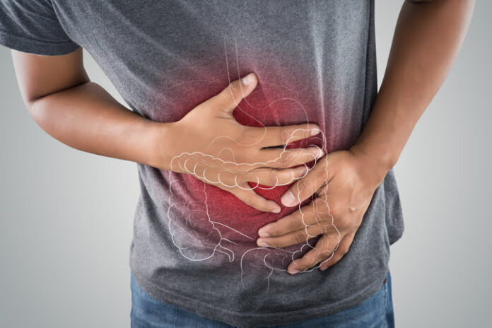 enfermedad inflamatoria intestinal