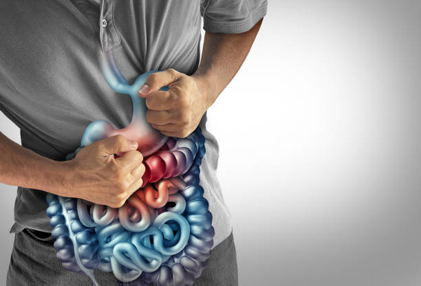 enfermedad de crohn