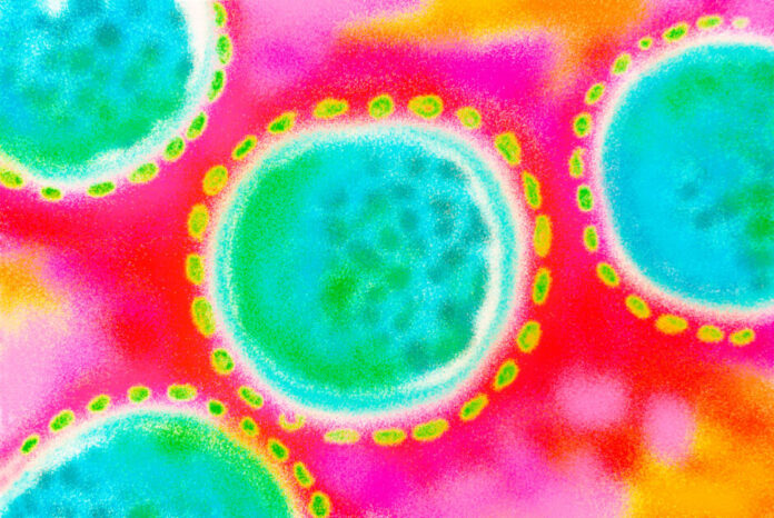 hantavirus-3 hantavirus