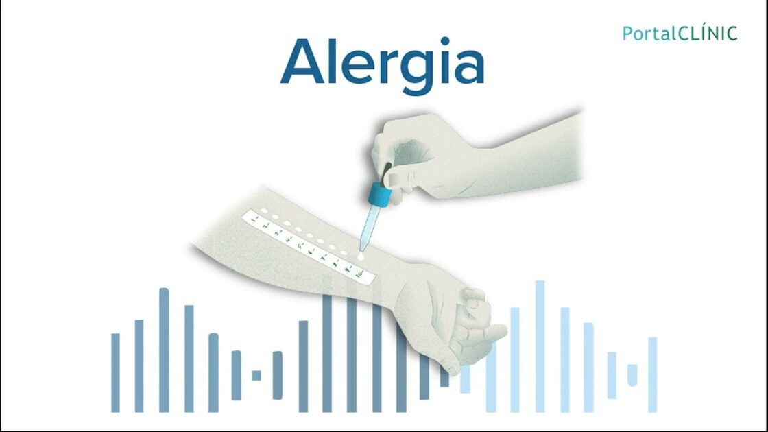‘Información que te cuida’ – Podcast | ALERGIA episode artwork