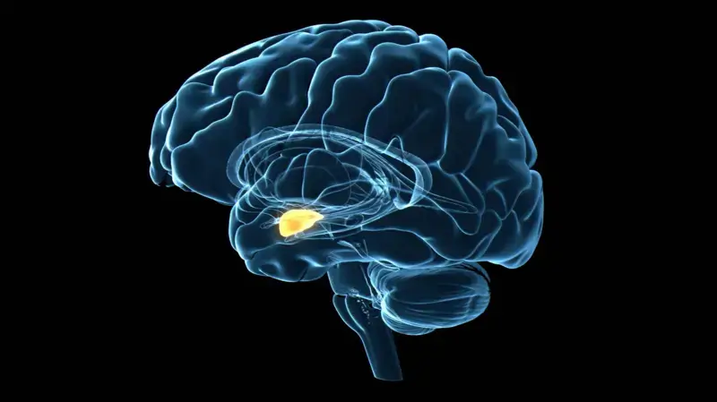 cerebro distress
