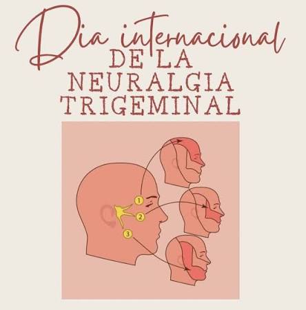 neuralgia del trigemino