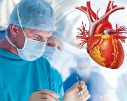 Cirugía Cardiaca y Cardiovascular