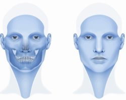 Cirugía maxilofacial