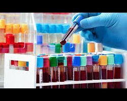 Hematología
