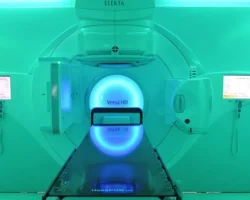 Oncologia Radioterápica