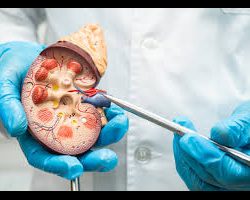 Urología